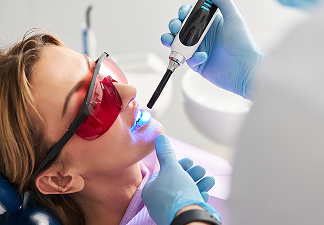 Fissure Sealants