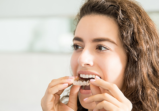 Invisalign