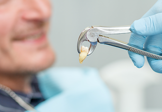 Tooth and Wisdom Tooth Removal